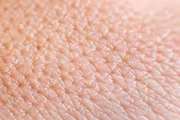 Researchers identify mechanisms that are essential for proper skin development